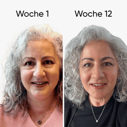 PDRN Micro-Infusion┃  Mikro-Nadeln für Zuhause