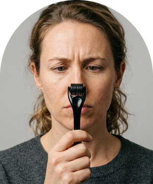 Derma- Roller