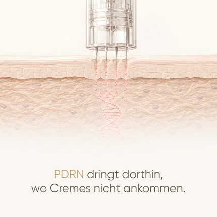 PDRN Micro-Infusion┃  Mikro-Nadeln für Zuhause