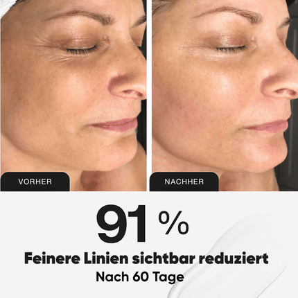 PDRN Micro-Infusion┃  Hauterneuerung für Zuhause